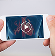 3D Animation & Modeling for Medical Research Videos 3D Animation & Modeling for Medical Research Videos