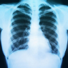 Digital X-rays Digital X-rays
