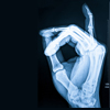 General Radiology and Fluoroscopy Interpretation Services General Radiology and Fluoroscopy Interpretation Services