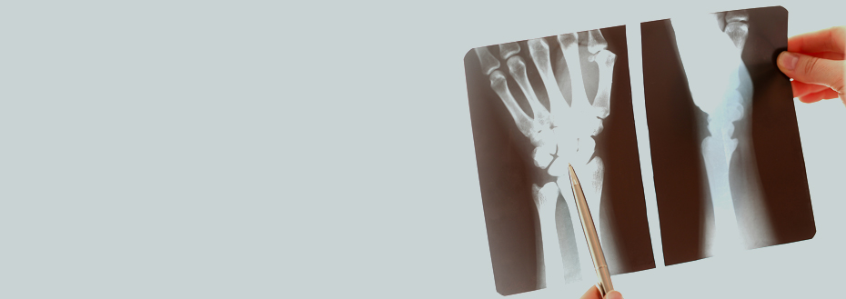 Outsource Bone Density Scan Services