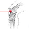 2D Orthopedic Animations