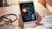 3D Medical Animation 3D Medical Animation