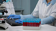Clinical Documentation Improvement Clinical Documentation Improvement