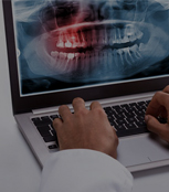 Dental X-ray Imaging Services